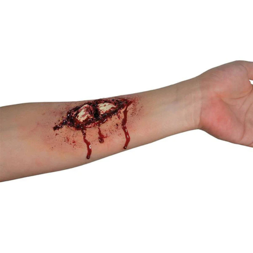 Application - Busted Bone